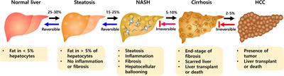 Major roles of kupffer cells and macrophages in NAFLD development